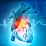 Cardiology follow-up for heart attack recovery Ayurveda