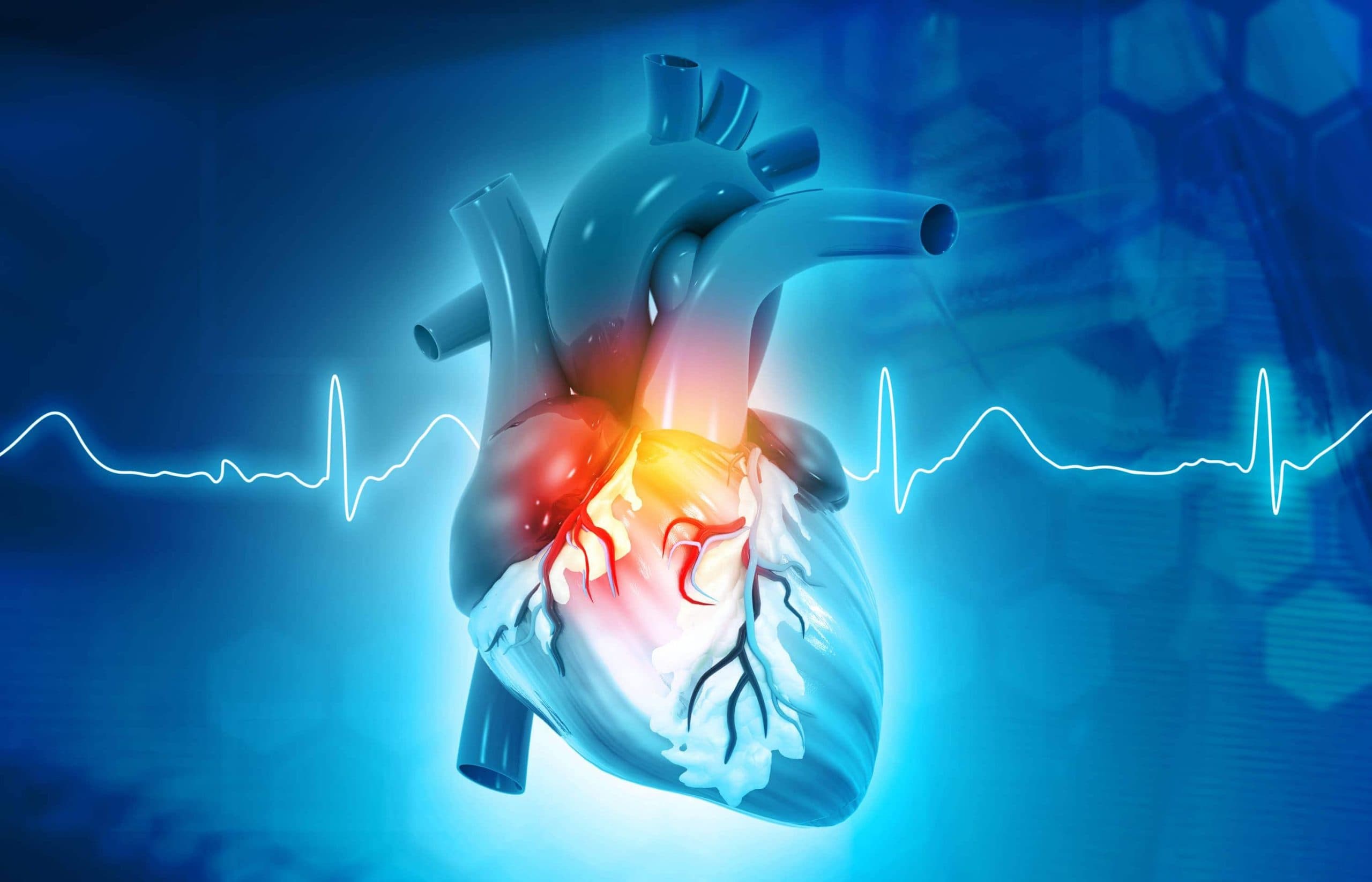 Cardiology follow-up for heart attack recovery Ayurveda